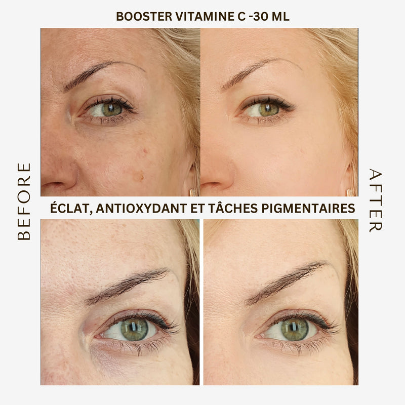 serum vitamine c avant apres